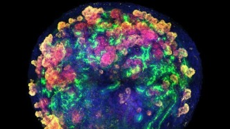 人肾类器官首次实现与猪肾功能整合