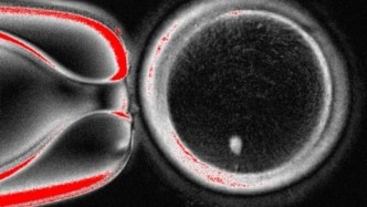 重磅突破：人類皮膚細(xì)胞被改造為卵子，還能成功受精！