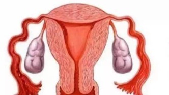 忌口了子宮肌瘤還在長？