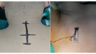 案例 | 沉睡4个月后，他终于醒了