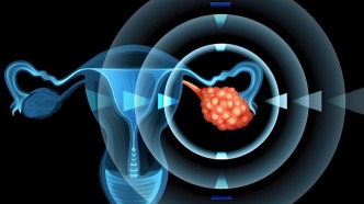 但行医者事，莫问“前程”艰——从卵巢癌的治疗到预防