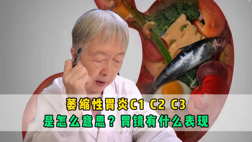 萎縮性胃炎C1C2C3是怎么意思？胃鏡有什么表現(xiàn)？