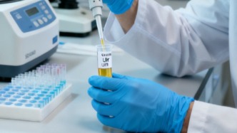 無痛血尿：身體拉響的“靜默警報(bào)”