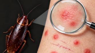 科普 | 家里沒有蟑螂，也會蟑螂過敏？