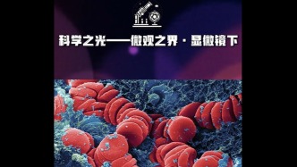 科學(xué)之光 | 微觀之界·顯微鏡下