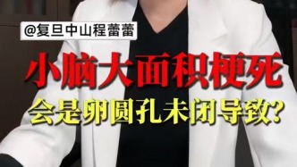 小脑大面积梗死，会是卵圆孔未闭导致？