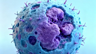 小心淋巴瘤這個(gè)“會(huì)跑”的腫瘤