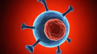 恶性肿瘤和这5点有关