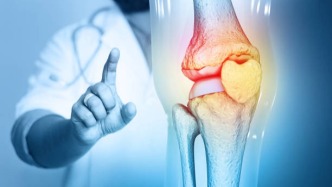 13年隨訪發(fā)現(xiàn)：干細(xì)胞真正改變膝骨關(guān)節(jié)炎的地方，不在關(guān)節(jié)腔里