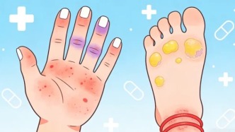 如何科學(xué)地應(yīng)對化療后手腳又紅又痛？