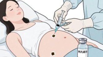  瘢痕子宫中孕引产，如何跨越子宫破裂的“雷区”？