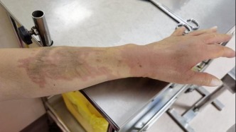 紧急提醒：过年“洗邋遢”，用这瓶东西时要注意！