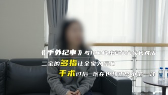 二宝的多指让全家人操心，手术过后现在也和正常小宝一样
