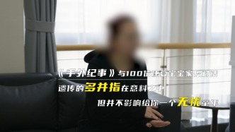 遗传的多并指在意料之中，但并不影响给你一个无忧童年