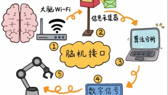 神经临床进入精准时代，神经调控精准攻克癫痫等脑疾病