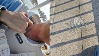 春季多发！小心空中飘着的这把“隐形利刃”，多人已被割伤！