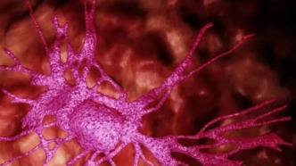 最新研究：阿尔茨海默病治疗出现新靶点，80%的早衰细胞来自同一种胶质细胞