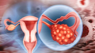 如何突破鉑耐藥卵巢癌的治療困境？