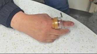 女子这样爱干净，却被紧急送医！“好习惯”用不对会“闯祸”