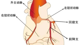 心梗如此可怕，該怎么預防？