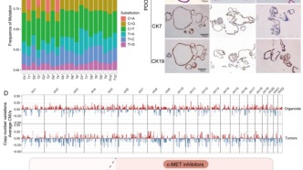 蘭大一院研究團(tuán)隊(duì)揭示膽管癌耐藥關(guān)鍵機(jī)制并提出新型聯(lián)合治療策略