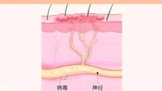 有一種生不如死的疼痛，甚至?xí)勰ツ愫芏嗄?，你還不重視嗎？