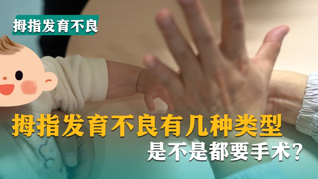 拇指發(fā)育不良有幾種類型，是不是都要手術(shù)?