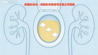 尿液里的泡沫：腎臟的求救信號，還是正?，F(xiàn)象？