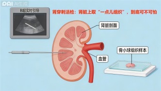腎穿刺活檢：腎臟上“取一點(diǎn)組織”，到底可不可怕？