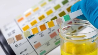 小便出現(xiàn)這 3 種變化，可能是腎臟在“求救”！千萬別忽視