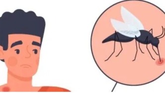 警惕蚊媒傳播！基孔肯雅熱、登革熱預(yù)防，防蚊是關(guān)鍵