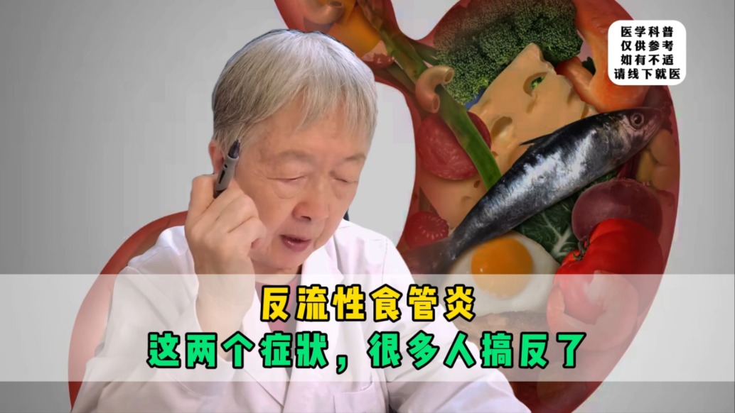 反流性食管炎最典型的兩個(gè)癥狀，很多人搞反了