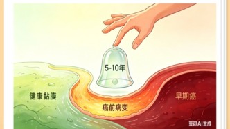 科普 | 能吃能喝也可能得癌？別錯(cuò)過5-10年“救命窗口”