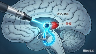 读懂脑积水，你需要知道的真相——不止是大脑里的 “水太多了