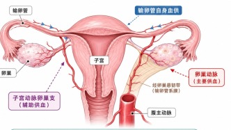 子宮切了，輸卵管留不留？一場(chǎng)關(guān)于“預(yù)防”與“血供”的辯論