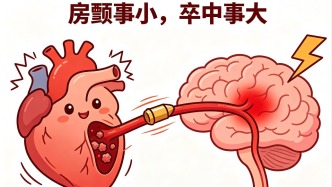 房顫事小，卒中事大