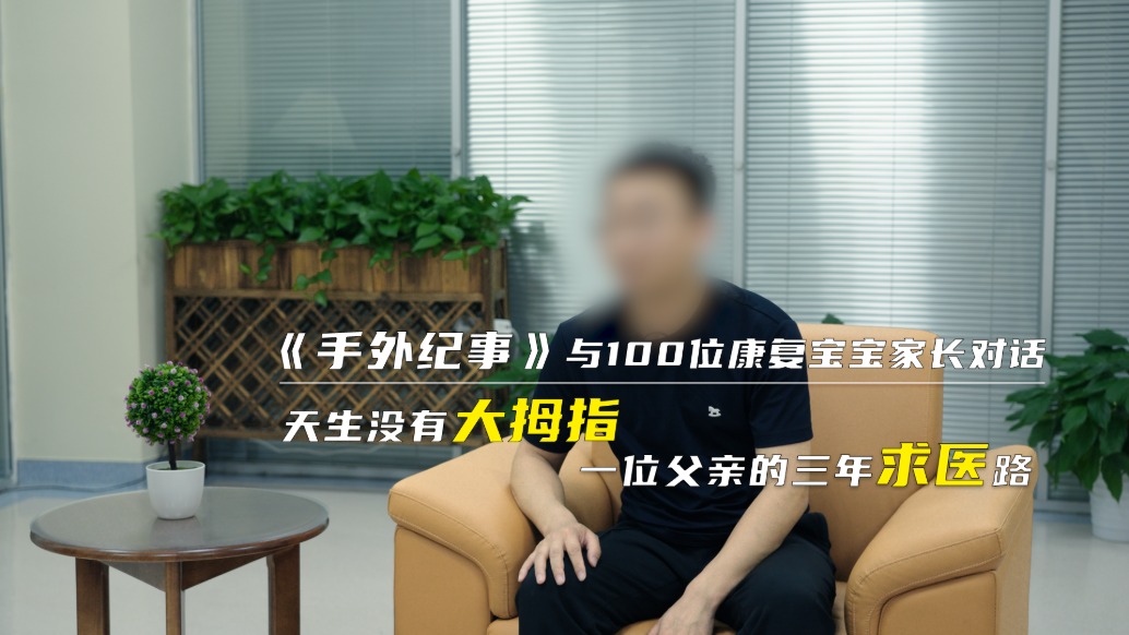 天生没有大拇指,一位父亲的三年求医路