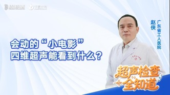 会动的“小电影”——四维超声能看到什么？
