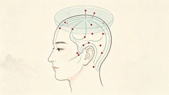 针灸治疗眩晕，告别头晕目眩