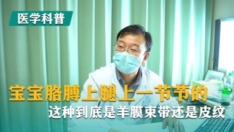 宝宝胳膊上腿上一节节的，这种到底是羊膜束带还是皮纹？