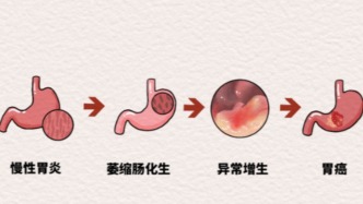 胃炎患者，凉拌菜不是禁忌，但要分人分料——脾胃虚寒者尤其注意