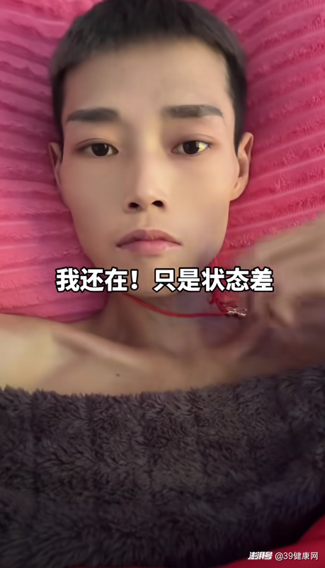 全球近一半肝癌在中国,再三提醒:家中的5种食物,尽早撤下餐桌
