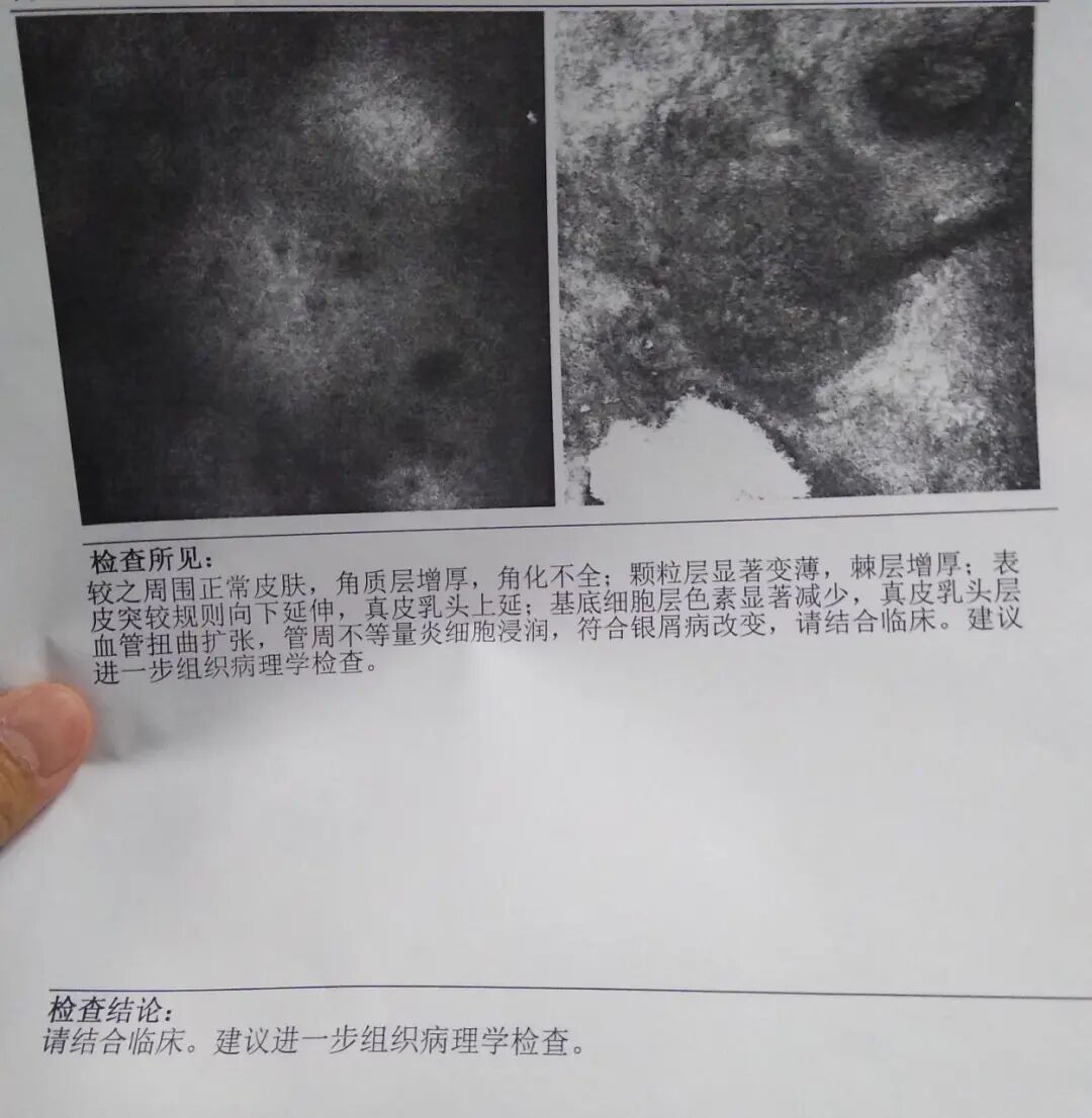 当红点从手背蔓延到浑身都是，我密集恐惧症都要犯了