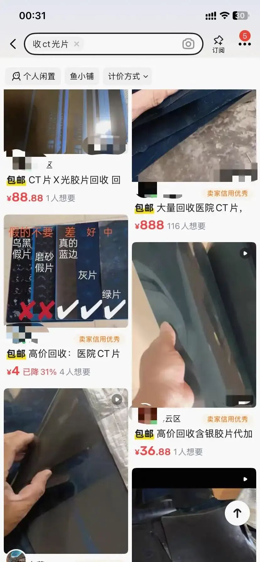什么叫医用胶片1.5元收一张旧CT片？专家提醒：别卖！-上海聚慕医疗器械有限公司