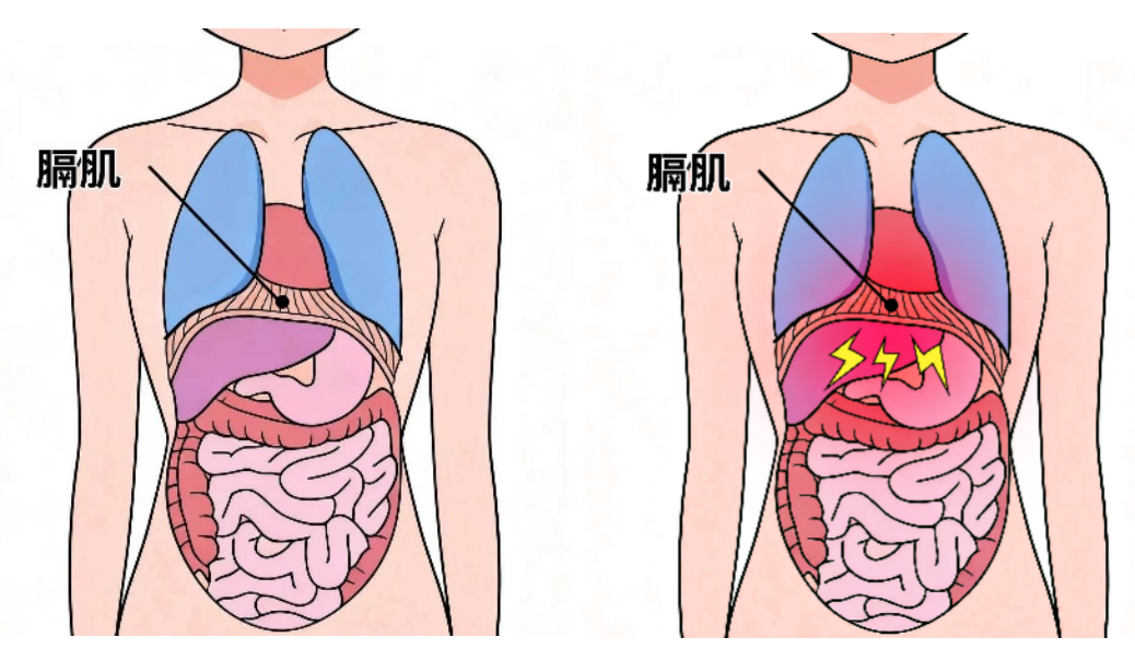 都是“打嗝”,其实不一样——带你分清嗳气和呃逆
