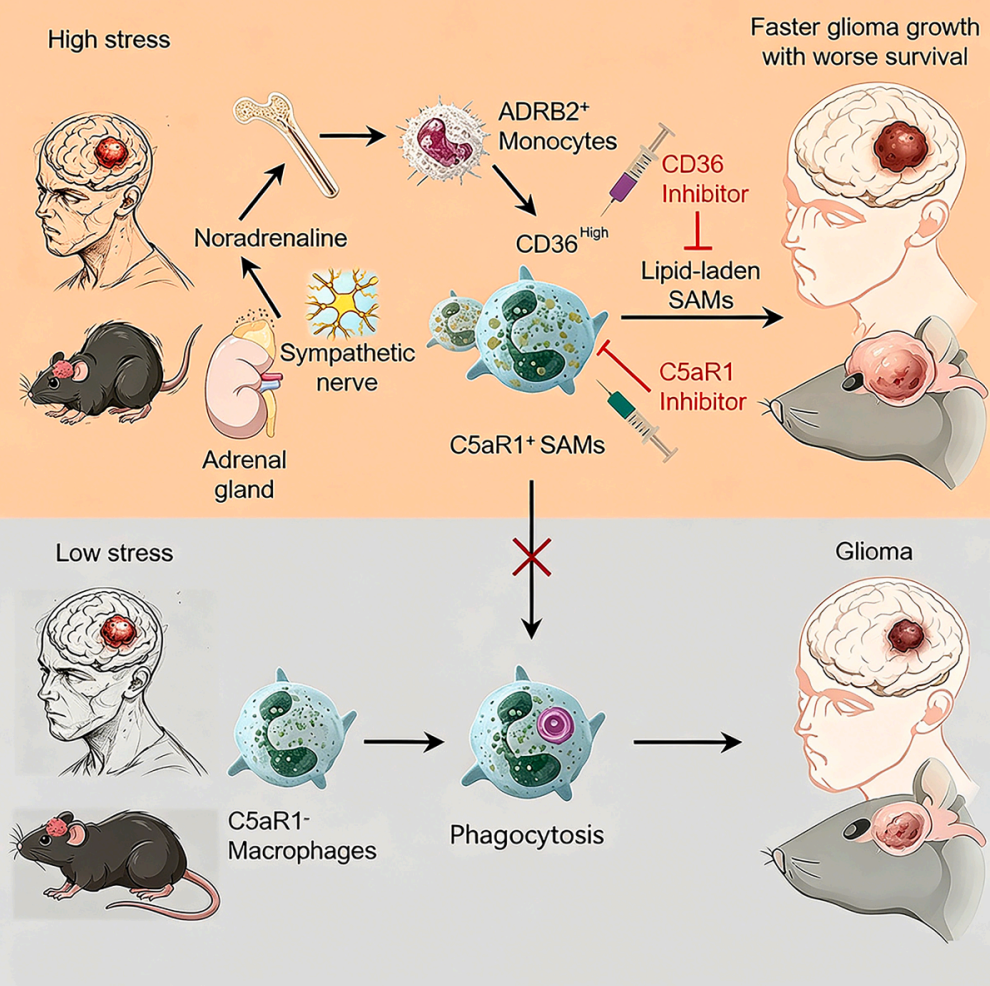 Cancer Cell:四川大学赵林桔/周圣涛等揭示慢性压力促进脑肿瘤的新机制,并提出治疗靶点及药物