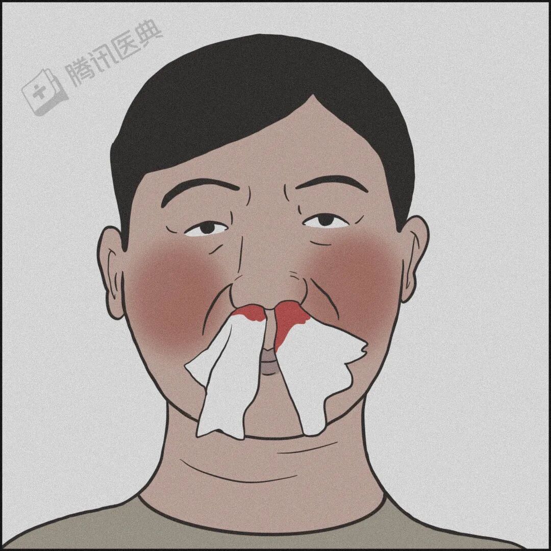 鱼刺卡喉、流鼻血仰头……别再这样“自杀式”急救了