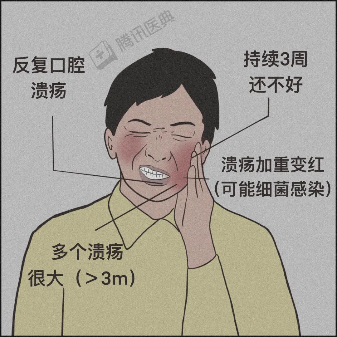 鱼刺卡喉、流鼻血仰头……别再这样“自杀式”急救了