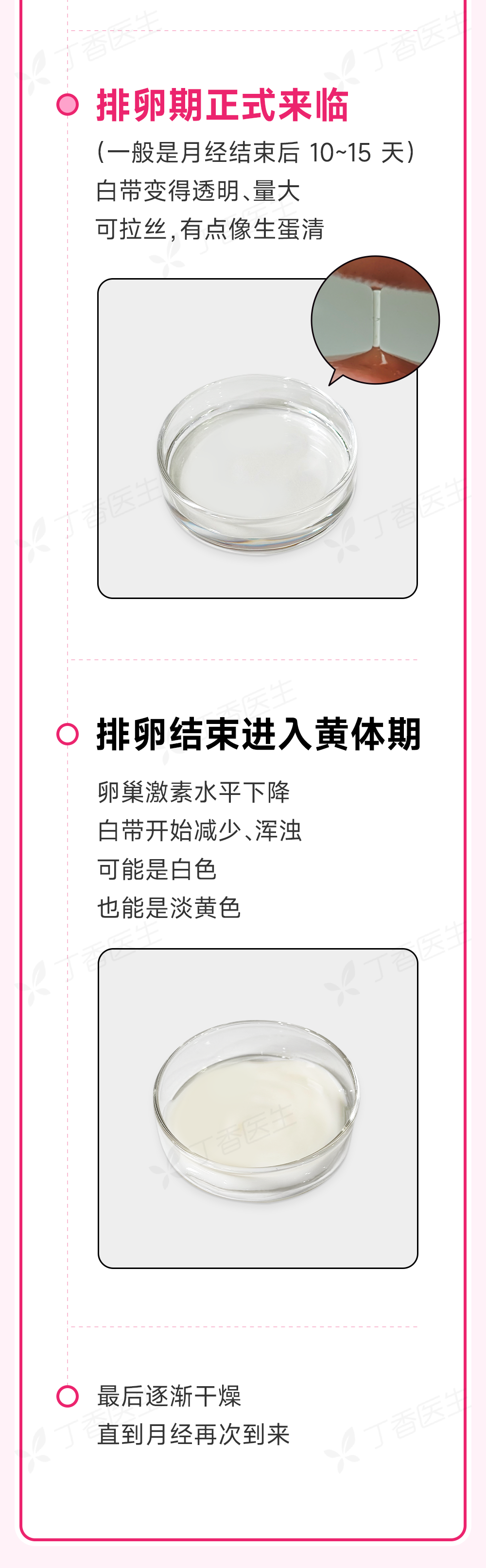 内裤上出现这 4 种情况,是身体在求救!中 1 个就要去医院