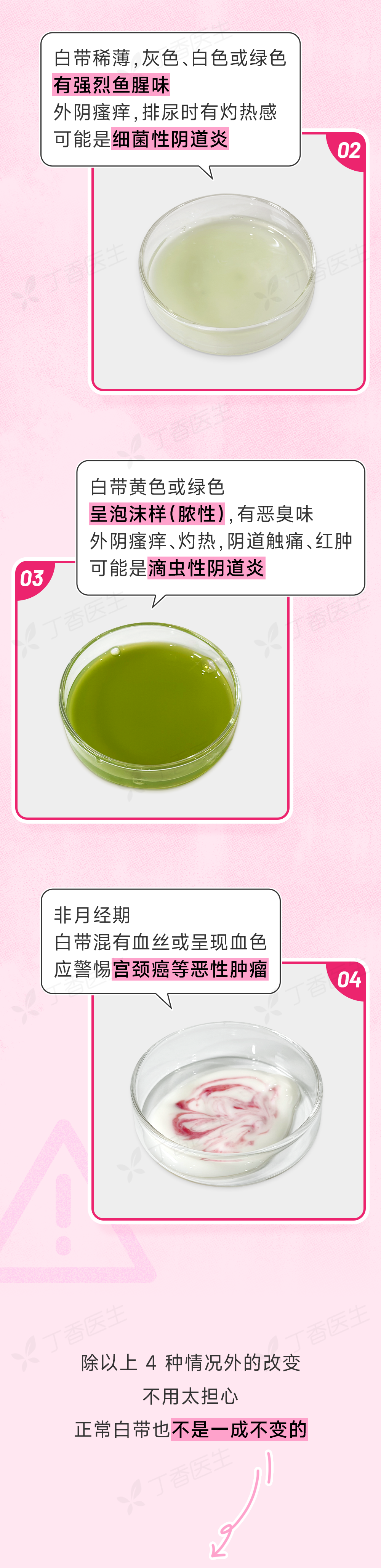 内裤上出现这 4 种情况,是身体在求救!中 1 个就要去医院